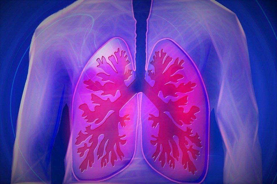 Medical illustration of inflamed human lungs highlighting respiratory distress, commonly associated with COPD.