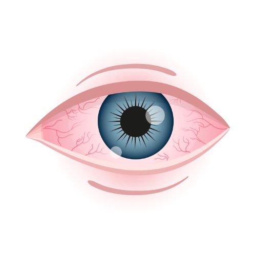 Minimizes Puffy Eyes