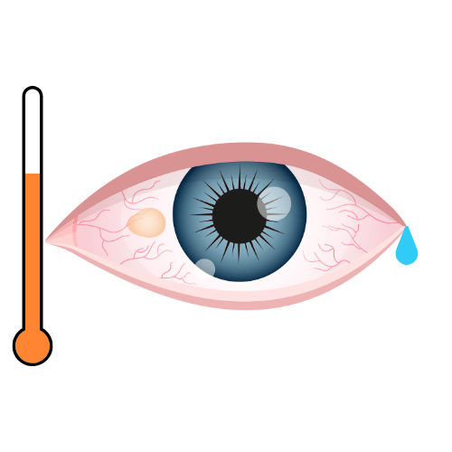 Soothes Dry Eyes