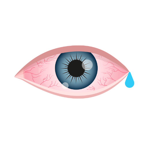 Supports Tear Flow
